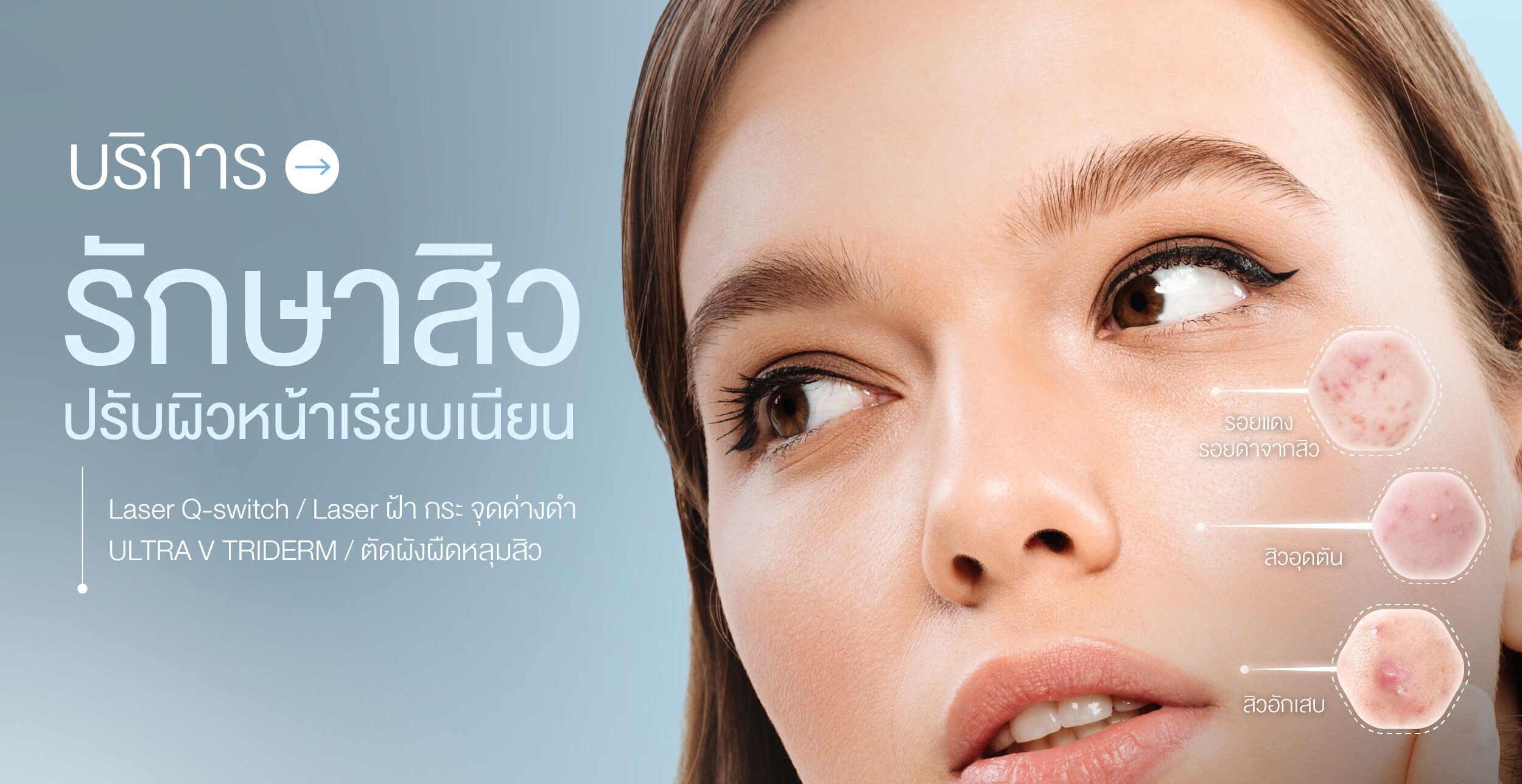 บริการรักษาสิว